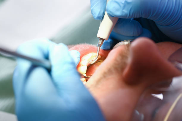 Best Emergency Treatment for Oral Infections in Oakdale, MN